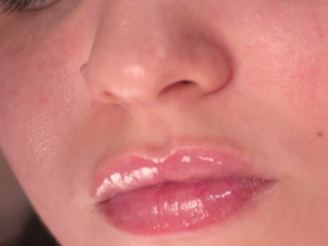 Lábios hidratados e com brilho ao final do protocolo DermoGlow Lips
